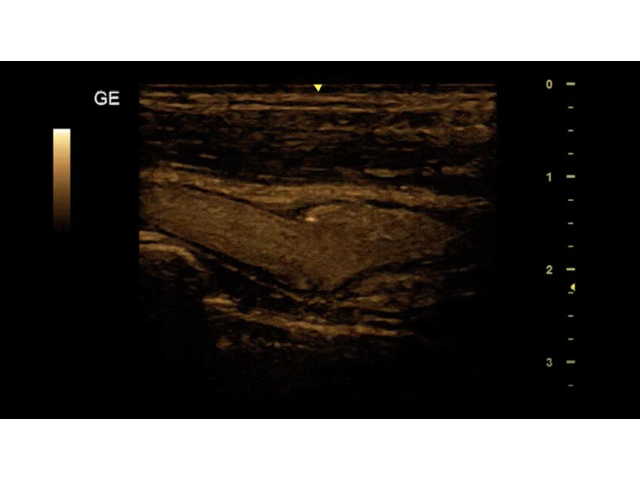 GE Versana Essential